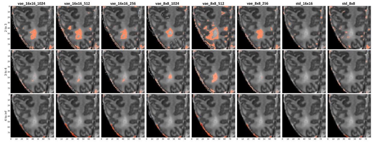 collage of brain imaging